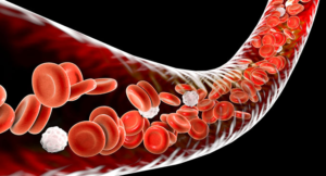 Blood Disorders