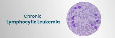 Chronic Lymphocytic Leukemia