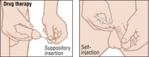 Impotence