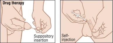 Impotence