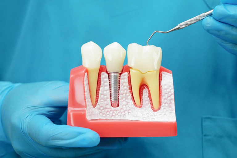 Implants and Cosmetics