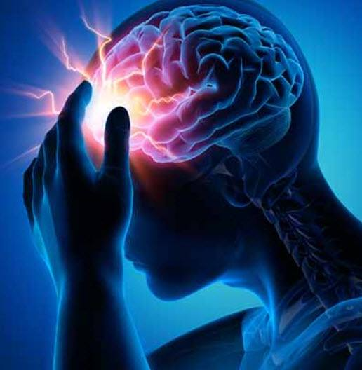Epilepsy
