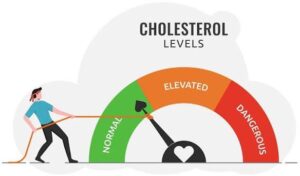 Cholesterol