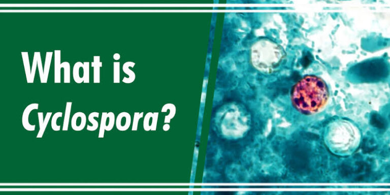 Cyclospora